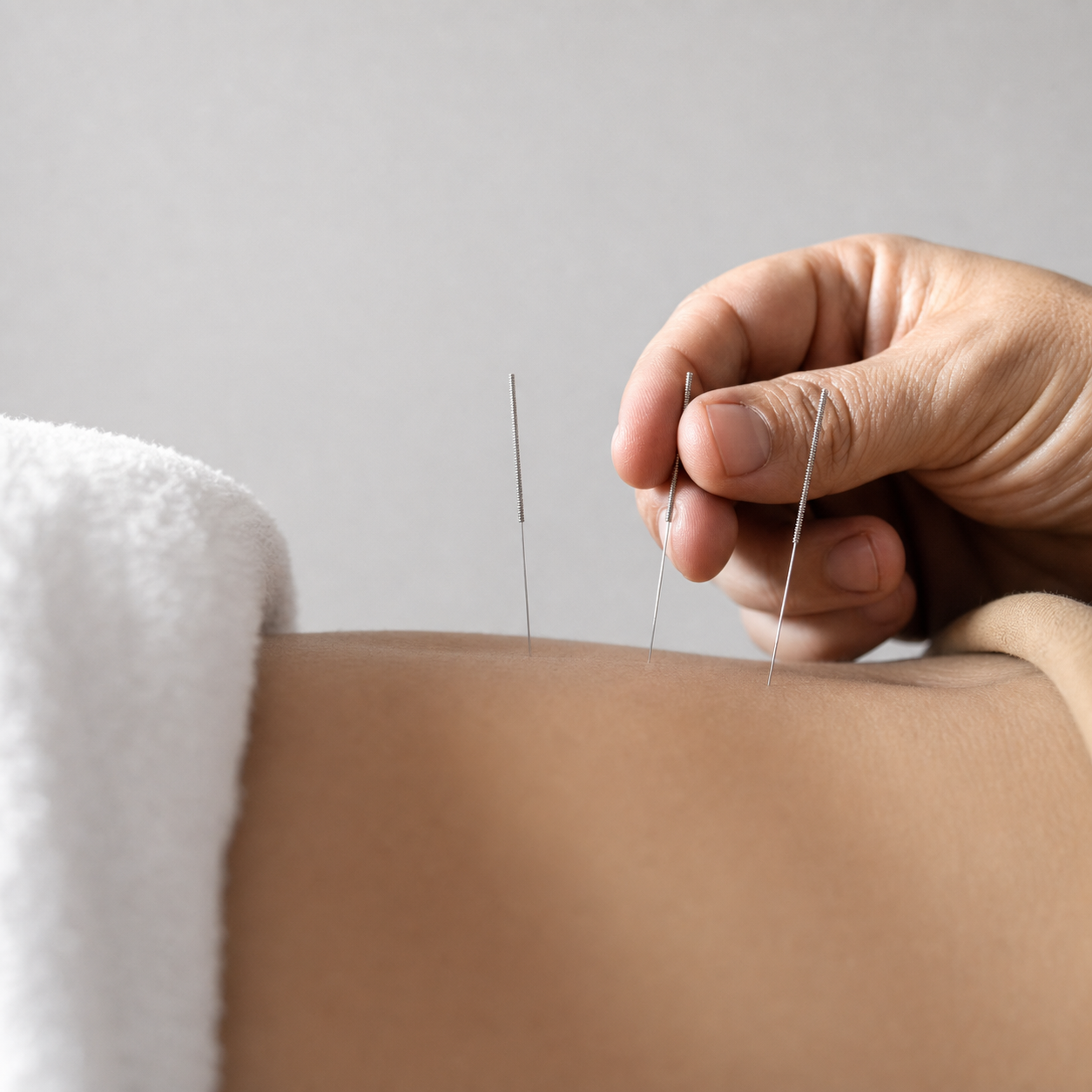 Clinical Dry Needling Program (CDNP)