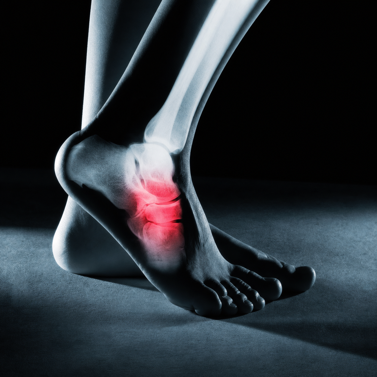 Ankle Sprains Workshop (Differential Diagnosis, Manual Therapy & Rehabilitation)